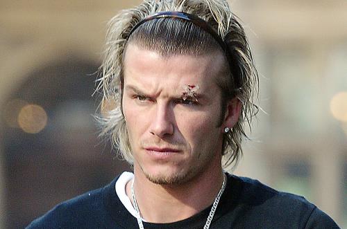 Beckham và vết thương do cú sút giầy của Sir Alex.